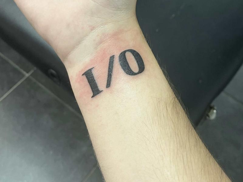 I/O on my wrist, which is a bit red from irritation